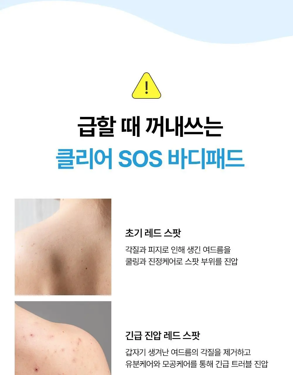 [등드름/가드름] 낫포유 클리어 SOS 바디패드 10매입 상세페이지 23